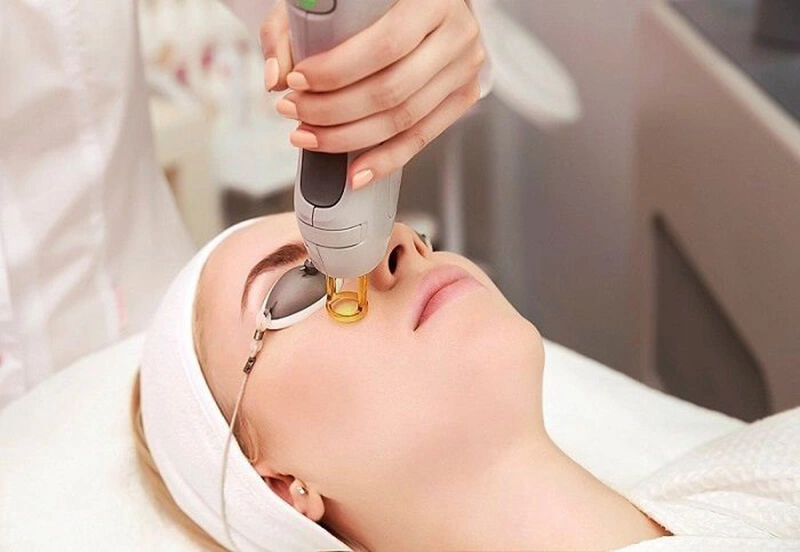 Chăm sóc da sau khi trị nám bằng Laser quyết định rất nhiều đến kết quả lâu dài của điều trị