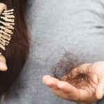 Có rất nhiều nguyên nhân khiến tóc rụng, gồm cả bệnh lý và tâm lý