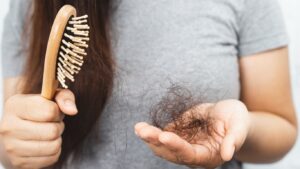 Có rất nhiều nguyên nhân khiến tóc rụng, gồm cả bệnh lý và tâm lý