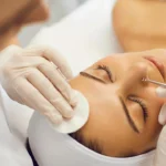 Việc lấy nhân mụn được chuyên viên thực hiện đúng kỹ thuật và nhẹ nhàng