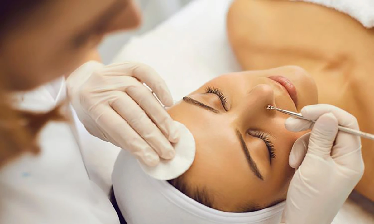 Việc lấy nhân mụn được chuyên viên thực hiện đúng kỹ thuật và nhẹ nhàng