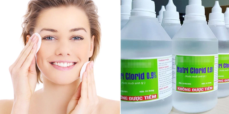 Bạn chỉ cần chăm sóc bằng cách rửa mặt bằng nước muối sinh lý
